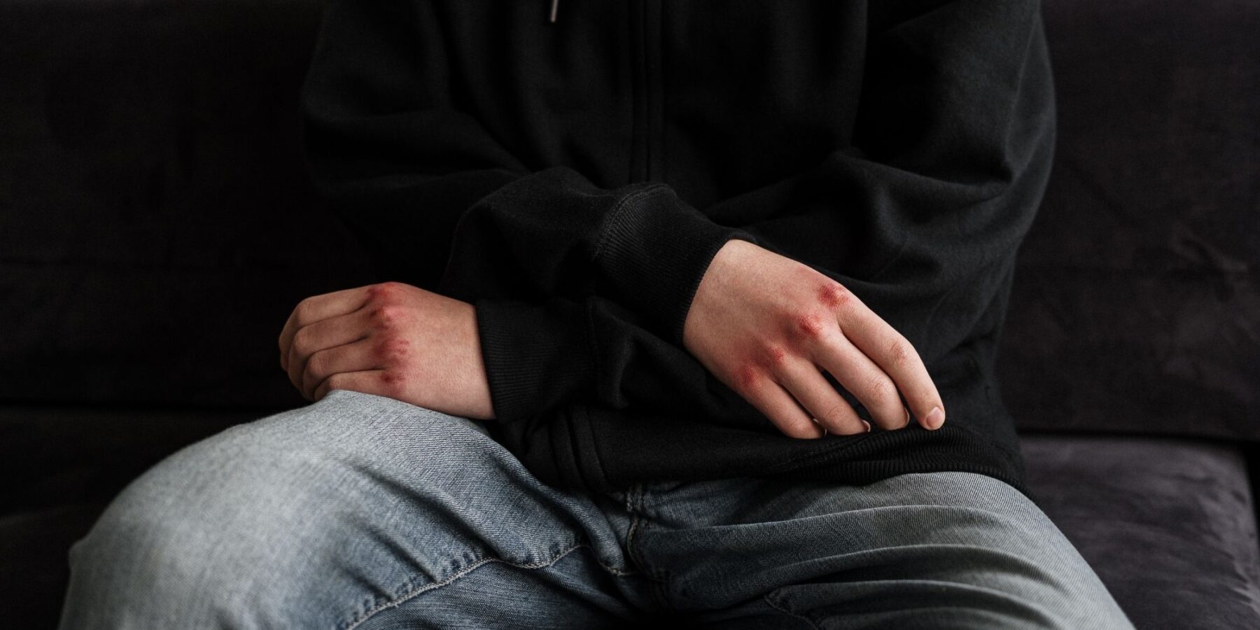 Queens Assault and Battery Defense Attorneys